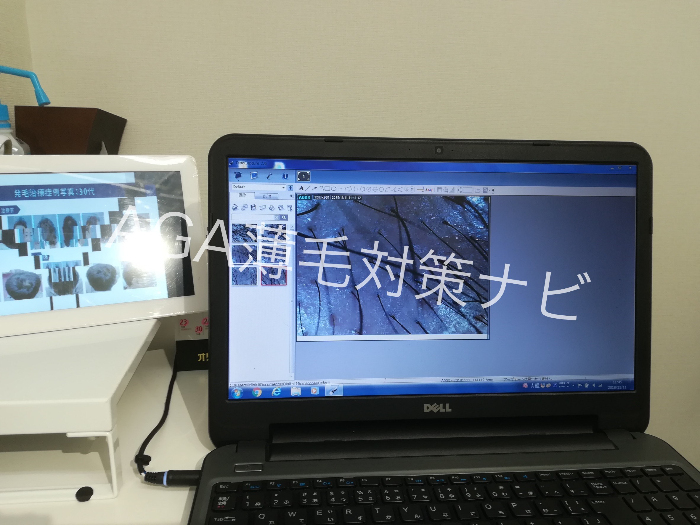 【体験談】AGAスキンクリニックの無料カウンセリング診断を体験!