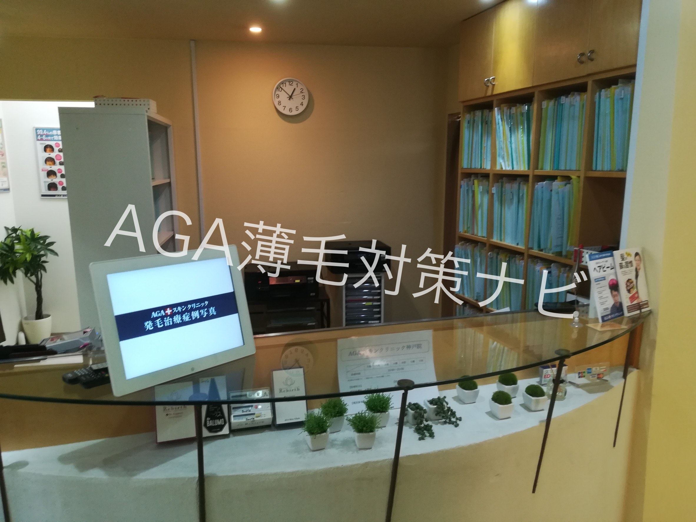 【体験談】AGAスキンクリニックの無料カウンセリング診断を体験!