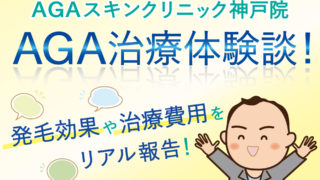 【AGA治療体験談】AGAスキンクリニックの発毛効果や費用を報告