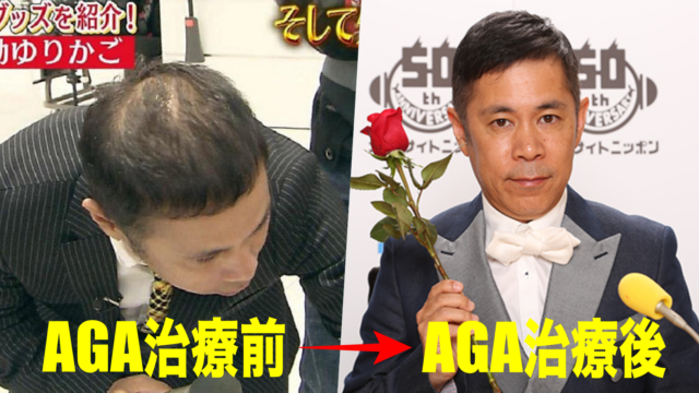 ナイナイ岡村隆史は薄毛・AGA治療で髪が復活！育毛方法や病院を暴露！